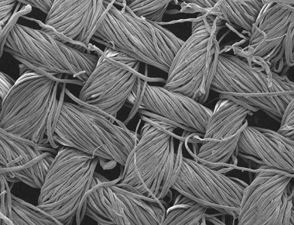 면 속에 섞여들어간 나노메탈 물질은 전자현미경으로만 볼 수 있다. 사진=로열멜번기술연구원. 사진=로열멜버른기술연구원(RMIT)대학교